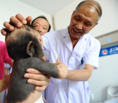 6个月<em>熊猫女婴</em>沪上求医 上海各界爱心潮涌 新