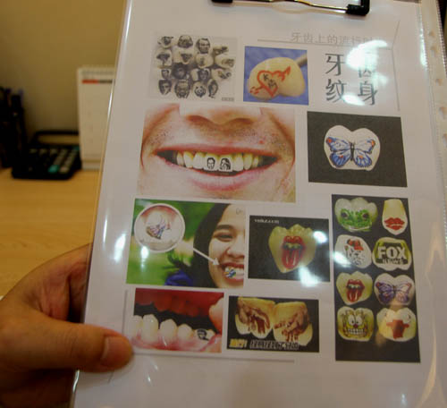 牙齿<em>纹身</em>好不好?专家称不利于牙齿健康 新华