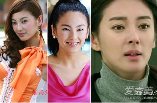 上海频道 正文 原标题:张雨绮闫妮李玟刘涛 割双眼皮后才是真女神