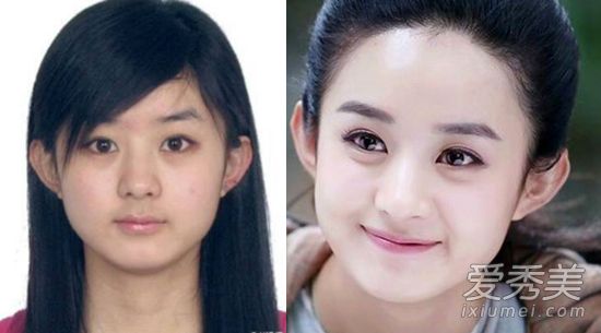 张雨绮杨幂赵丽颖 割双眼皮后才是真女神?